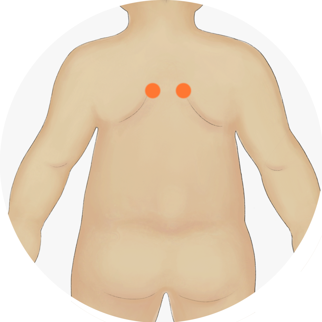 Differentiating Coughs: Cold, Heat, and Dryness for Effective Treatment