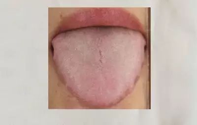 Exploring the Secrets of the Body Through Tongue Diagnosis