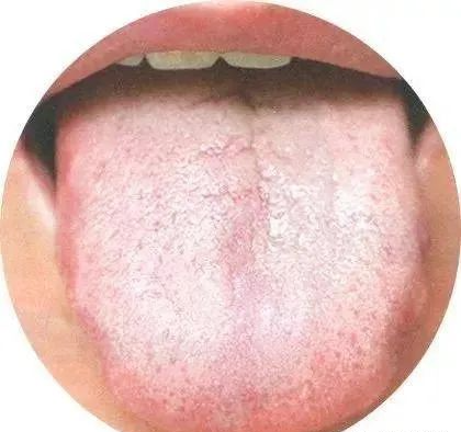 130 High-Definition Tongue Diagnosis Charts (Recommended for Collection)