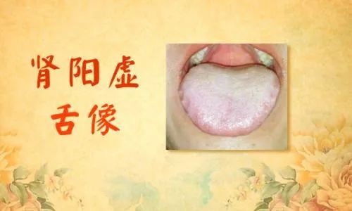 Why Do Kidney Yang Deficiency Remedies Seem Ineffective?