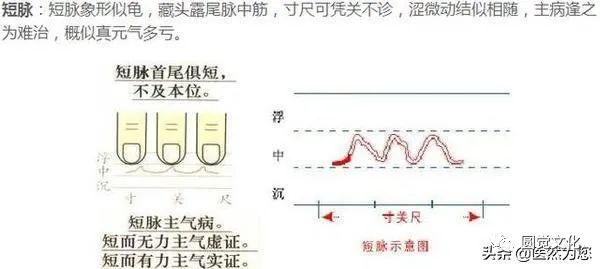 Understanding Pulse Patterns: Xu Mai, Wei Mai, Xi Mai, Dai Mai, and Duan Mai Explained for Everyone