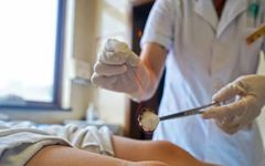 The Marvel of Fire Needle Therapy in Traditional Chinese Medicine