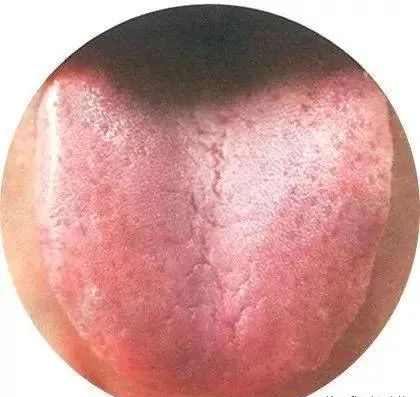 130 High-Definition Tongue Diagnosis Charts (Recommended for Collection)