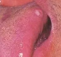 Understanding Tongue Diagnosis in Traditional Chinese Medicine (with Tongue Diagnosis Illustrations)