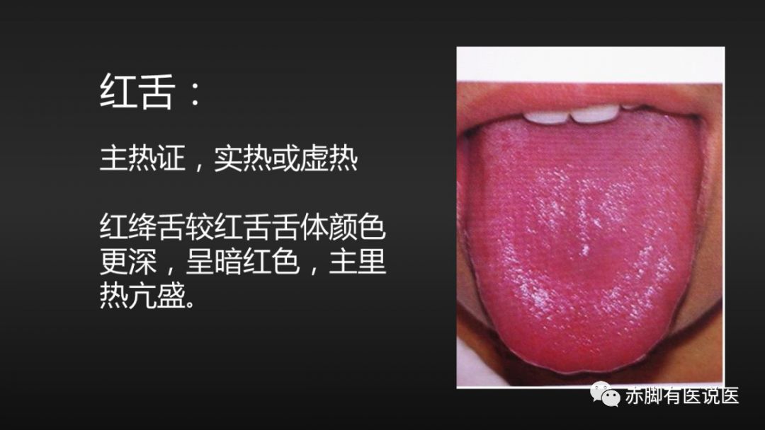 Understanding Your Tongue Diagnosis in 10 Minutes
