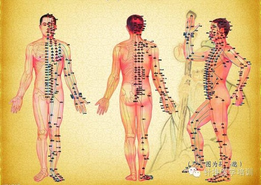 Techniques for Cupping Therapy