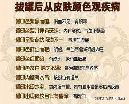 The Profound Knowledge of Cupping Therapy in Traditional Chinese Medicine