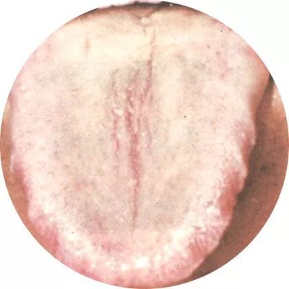 The Most Comprehensive High-Definition Real Tongue Diagnosis: Observing Tongue Patterns to Understand Internal Organs (Collection Edition)
