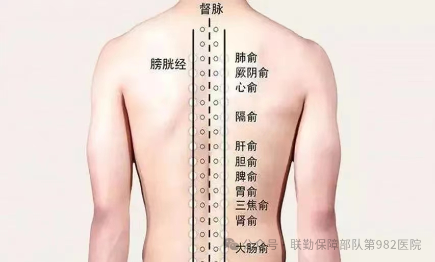 Traditional Chinese Medicine Therapy: 'Leopard Spot' Cupping Therapy