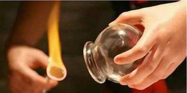 Cupping Burns and Steaming Risks: Health or Hazard?