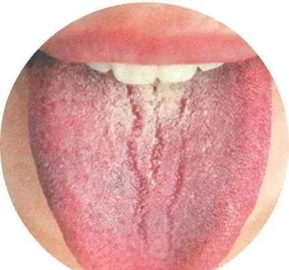 130 High-Definition Tongue Diagnosis Charts (Recommended for Collection)