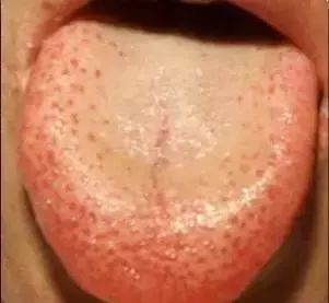 The Most Comprehensive Guide to Tongue Diagnosis! Master It and Become a Tongue Diagnosis Expert