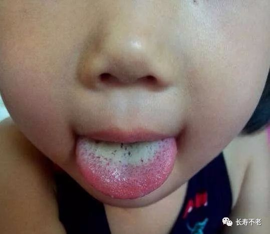 The Most Comprehensive TCM Tongue Diagnosis Atlas: Observe the Tongue, Understand the Whole Body!