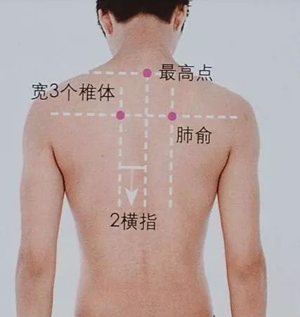 50 Common Acupuncture Points for Treating Various Ailments