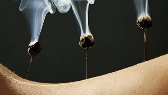 The Most Comprehensive Explanation of Moxibustion Methods and Techniques (A Must-Read for Beginners)