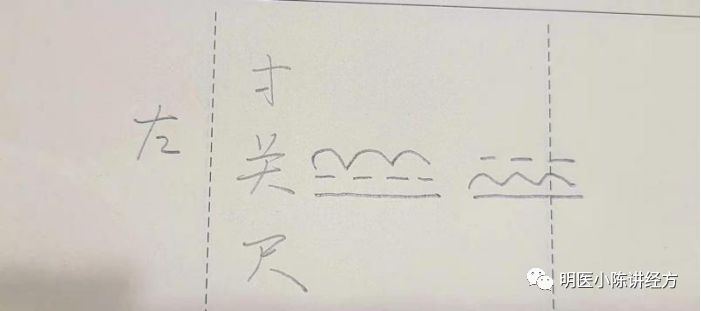 Lecture 130 - Understanding the Pulse of Xiao Chai Hu
