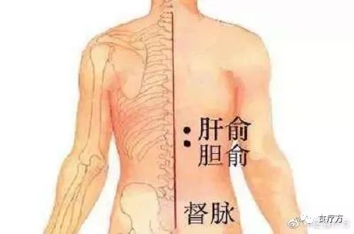Comprehensive Guide to Cupping Therapy for the Back