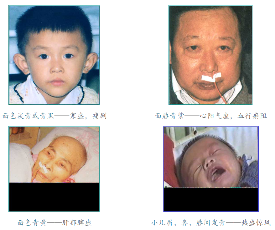 Diagnosis in Traditional Chinese Medicine