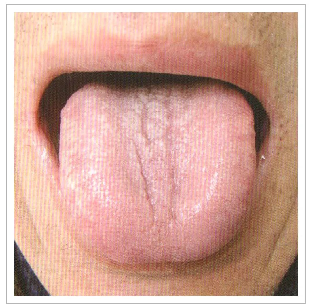 Analysis of Tongue Quality and Movement in Traditional Chinese Medicine