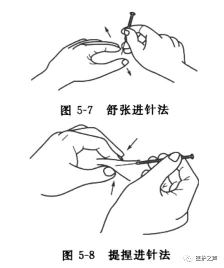 Acupuncture Techniques - Discussion on Needle Insertion Techniques: Fine Needle Insertion Method [Part 1]