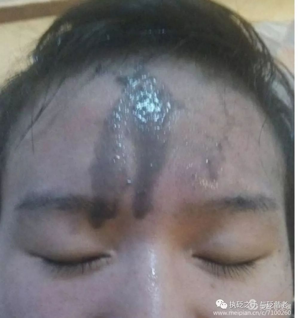 Black Sha: The Surprising Discovery of Copper Gua Sha