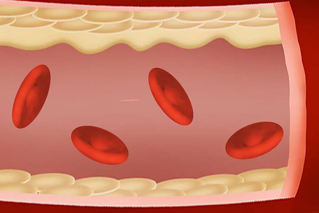 The Lesser-Known Benefits of Poria (Fu Ling) and Its Precautions