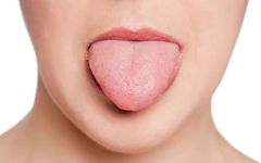 10 Types of Tongue Appearance That May Indicate Illness