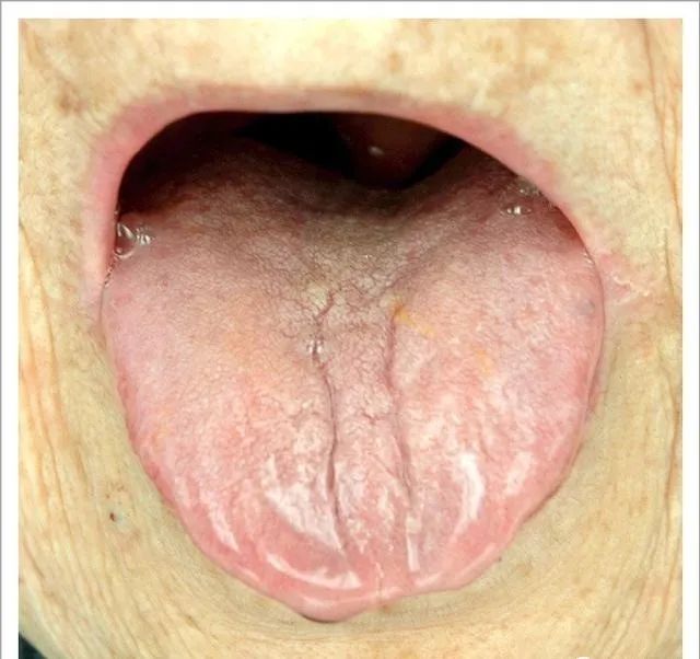 Traditional Chinese Medicine Tongue Diagnosis: 26 Clinical High-Definition Tongue Diagnosis Images with Analysis