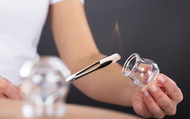 Cupping Therapy: A Traditional Chinese Medicine Approach to Health