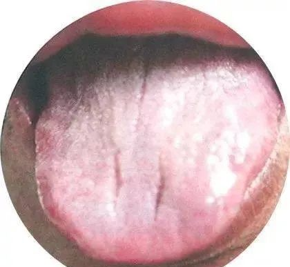 130 High-Definition Tongue Diagnosis Charts (Recommended for Collection)