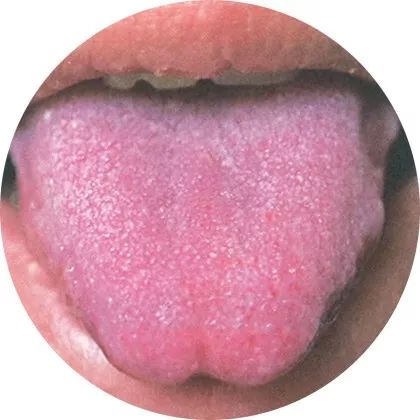 The Most Comprehensive High-Definition Real Tongue Diagnosis: Observing Tongue Patterns to Understand Internal Organs (Collection Edition)