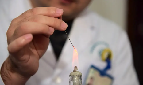 Understanding Fire Needle Therapy in Traditional Chinese Medicine