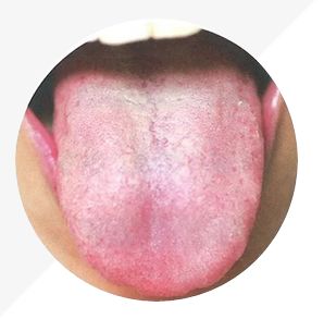 Understanding Tongue Diagnosis in TCM: Insights into Health from Tongue Appearance (Part 2)
