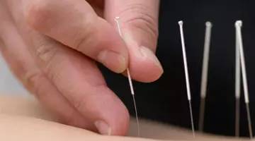 Three Forbidden Acupuncture Points in Acupuncture: Remember These to Get Started