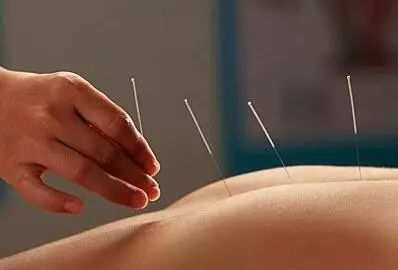 Acupuncture Techniques (A Must-Read for Acupuncturists)