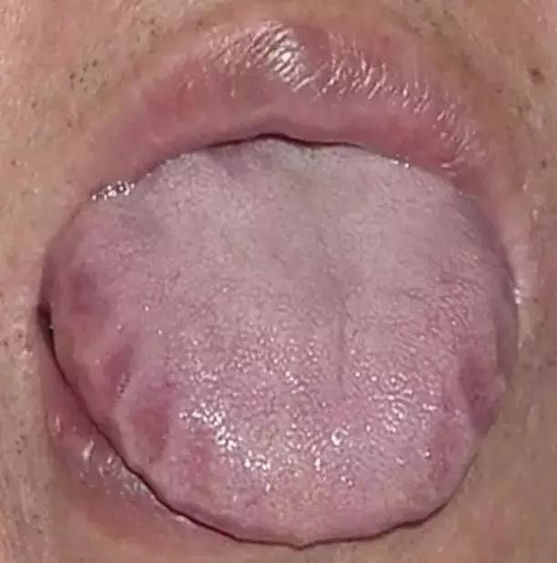 The Most Comprehensive Guide to Tongue Diagnosis! Master It and Become a Tongue Diagnosis Expert
