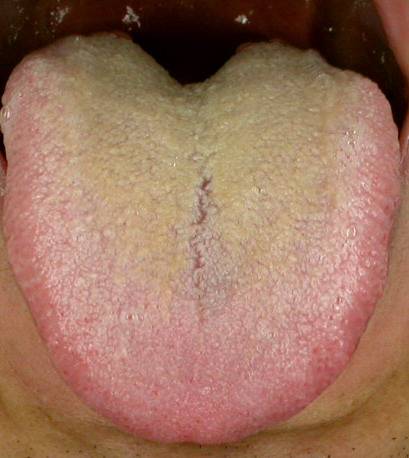 How to Regulate Phlegm-Damp Constitution Without Supplementation?