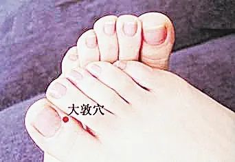 Bloodletting Therapy for 24 Difficult Diseases: A Unique TCM Approach