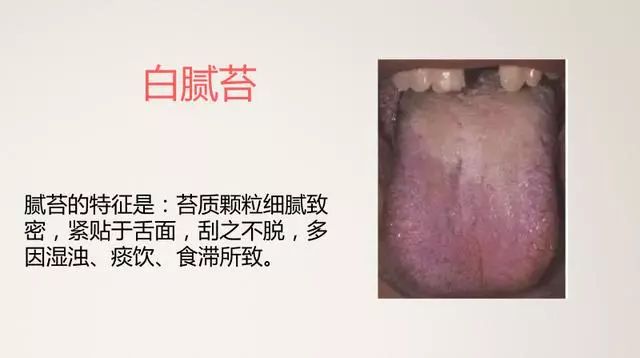 The Most Comprehensive TCM Tongue Diagnosis Atlas: Observe the Tongue, Understand the Whole Body!