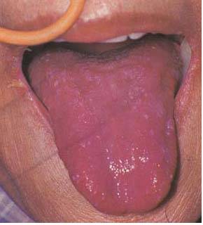 62 High-Definition Tongue Diagnosis Charts with Illustrations (Collector's Edition)