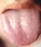 Comprehensive Guide to Tongue Diagnosis: Learn How Your Tongue Reflects Your Health!