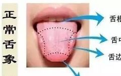 Tongue Diagnosis in Traditional Chinese Medicine: Observation of the Tongue