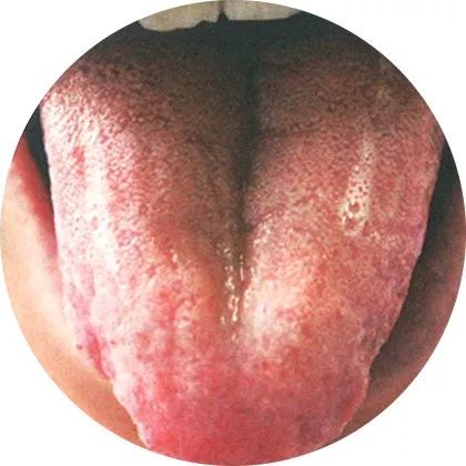 The Most Comprehensive High-Definition Real Tongue Diagnosis: Observing Tongue Patterns to Understand Internal Organs (Collection Edition)