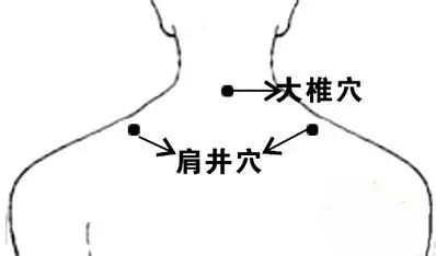 Conditions That Can Be Alleviated by Gua Sha