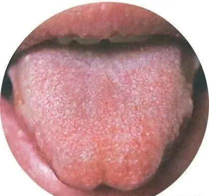 130 High-Definition Tongue Diagnosis Charts (Recommended for Collection)