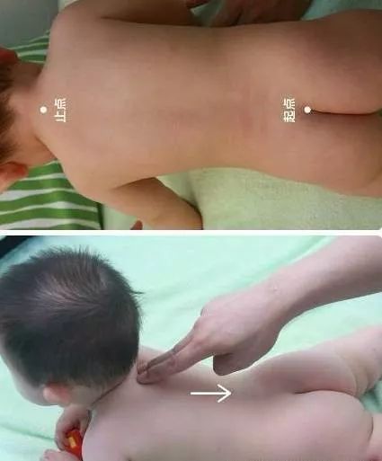 21 Pediatric Tuina Techniques to Easily Address Common Childhood Ailments!