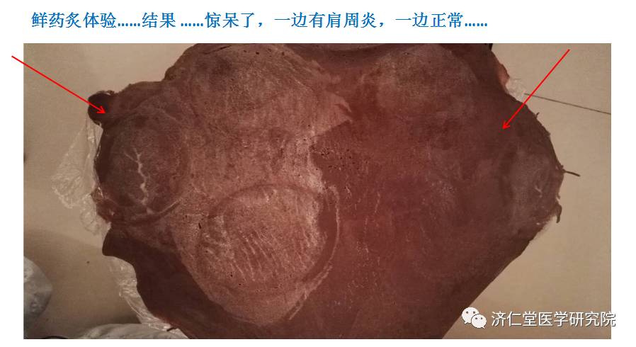 Understanding the Six Evils in Traditional Chinese Medicine
