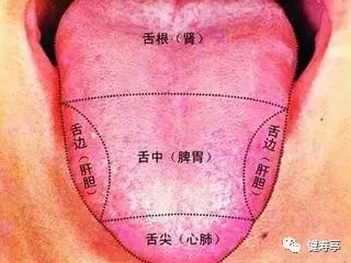Understanding Tongue Diagnosis in Traditional Chinese Medicine (with Tongue Diagnosis Illustrations)