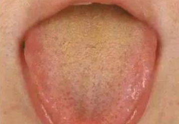 Liver Qi Stagnation Leads to Blood Stasis, Spleen Deficiency, and Heat Transformation! One Formula to Resolve Liver Qi Issues!