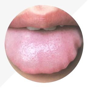 Analysis of High-Definition Tongue Diagnosis Charts: Understanding Health Through Your Tongue (Part 1)